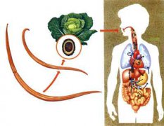 如何治疗蛔虫病